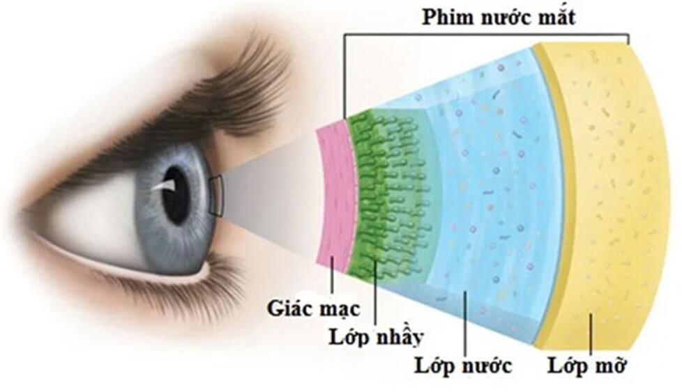 Nguyên nhân gây khô mắt có thể do yếu tố bệnh lý hay môi trường gây ra, cần thăm khám với bác sĩ mắt để biết nguyên nhân và cách điều trị phù hợp.